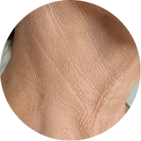 <p>Crepey, paper-thin-<br/>looking texture</p>