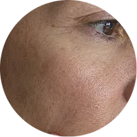 <p>Skin that looks thinner, drier or less resilient</p>