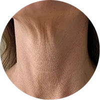 <p>Chest lines that linger <br/>after waking up</p>