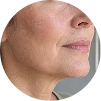 <p><strong>Cheeks and contours that appear softer</strong></p>