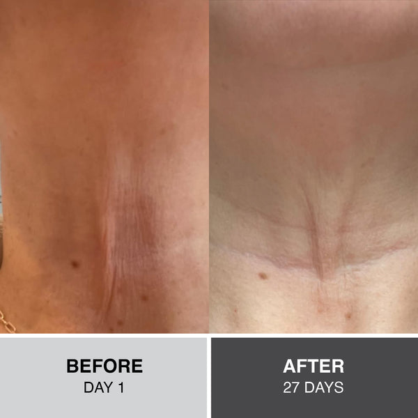 Plant Labs Neck Sculpt+ Roll-On (50mL) - JUST LAUNCHED