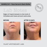 Plant Labs Ultimate Lift & Firm Duo (Bundle 1)